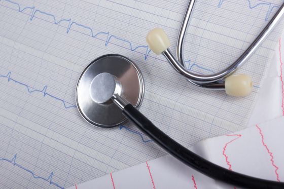 Cardiogram pulse trace and stethoscope concept for cardiovascular medical exam, closeup
